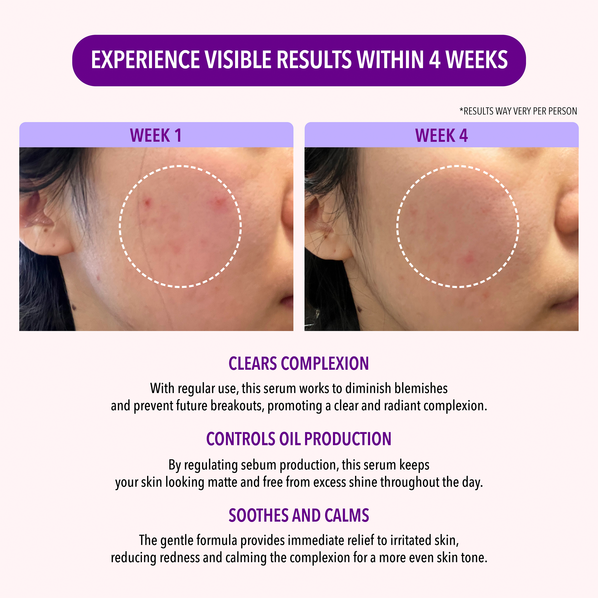 Oil Control Skincare Collection ($59 Value)